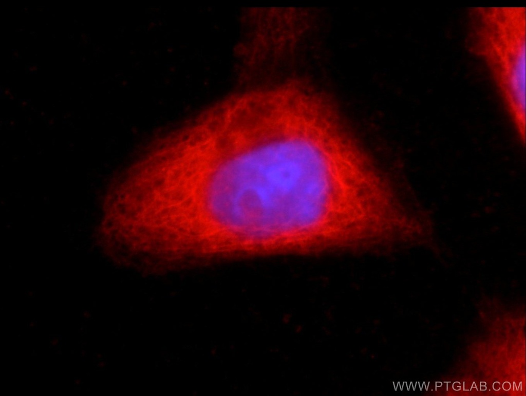 CSK Monoclonal antibody