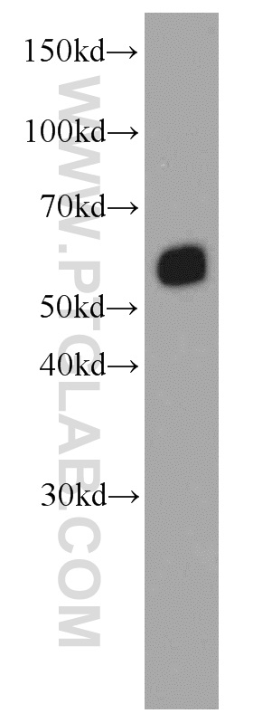 SMARCD1 Monoclonal antibody