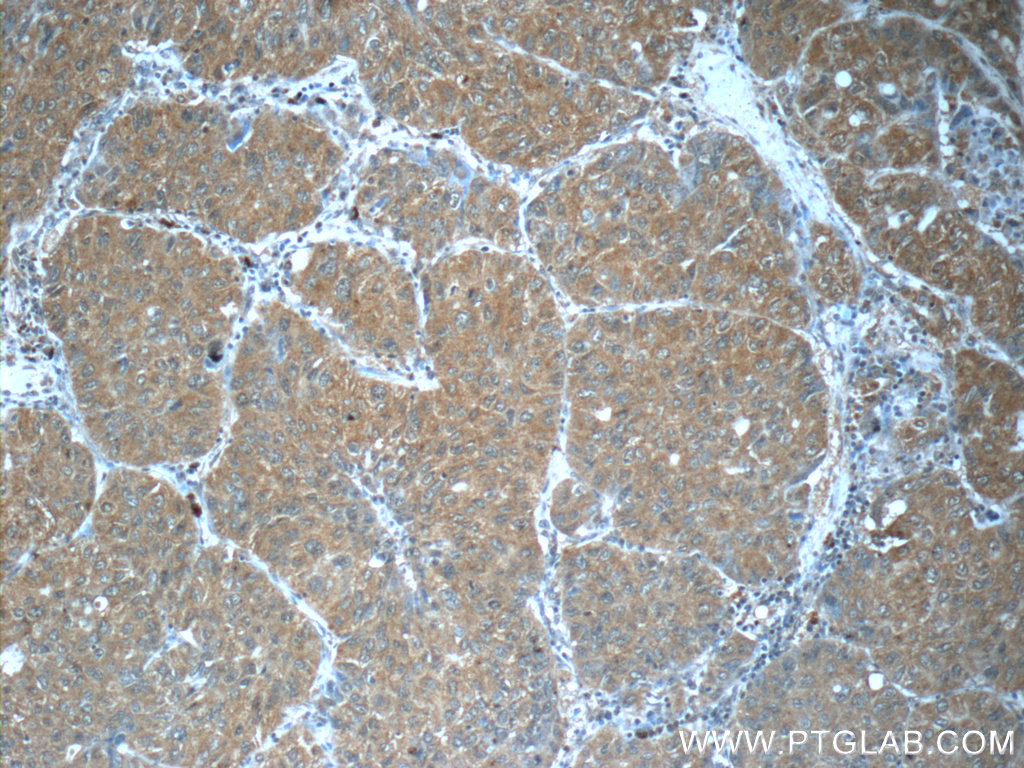 FUT8 Monoclonal antibody
