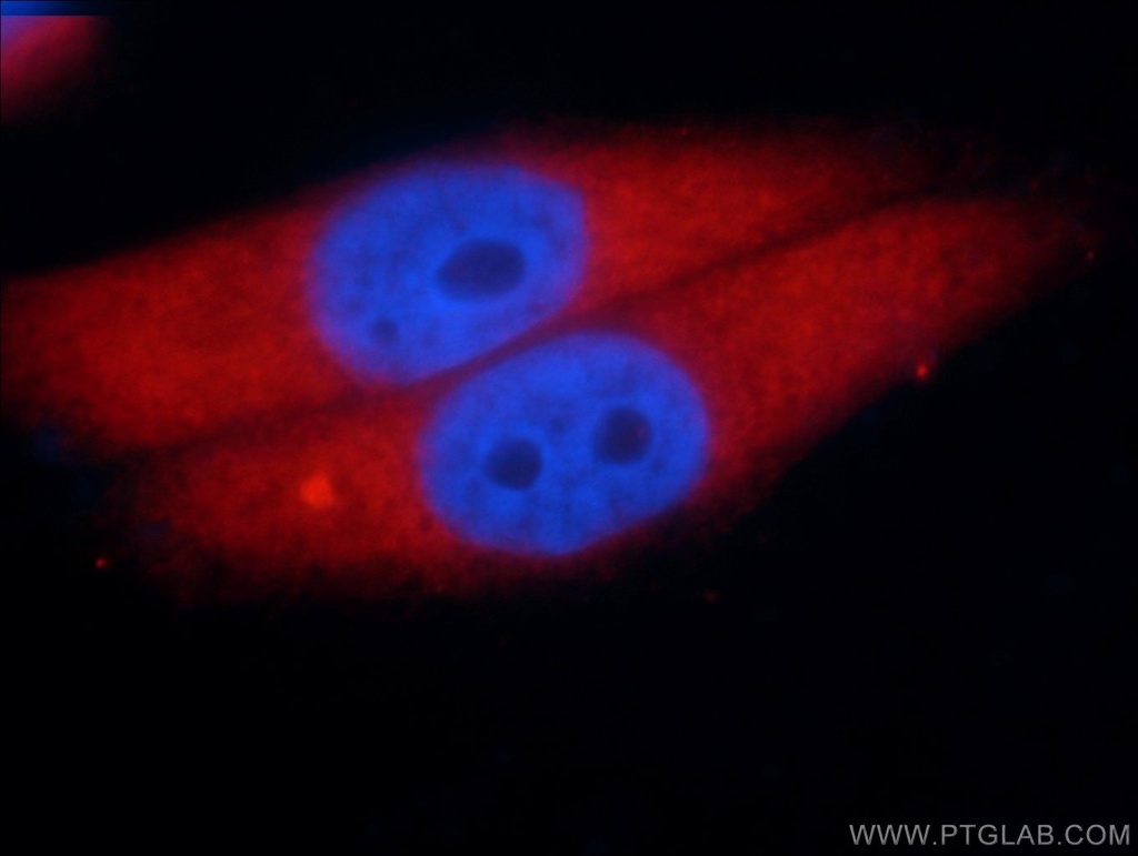Aldolase C Monoclonal antibody