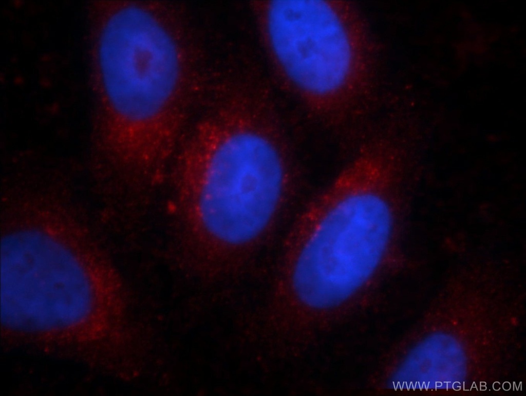 Alpha Galactosidase A Monoclonal antibody