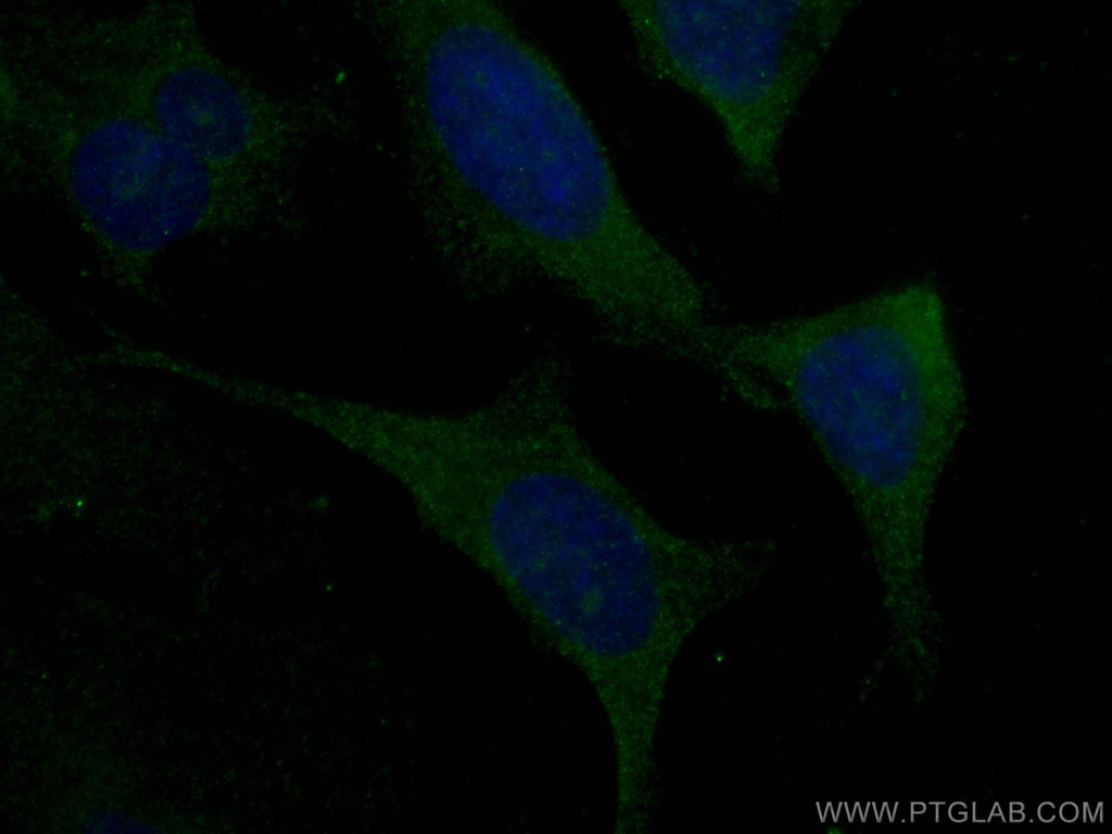 Kininogen 1 Monoclonal antibody