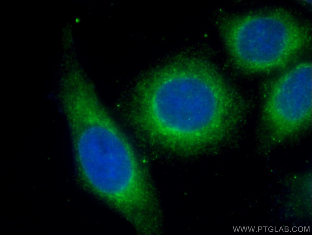 Alpha-2-Macroglobulin Monoclonal antibody