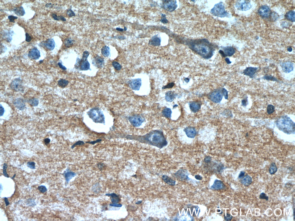 OXA1L Monoclonal antibody