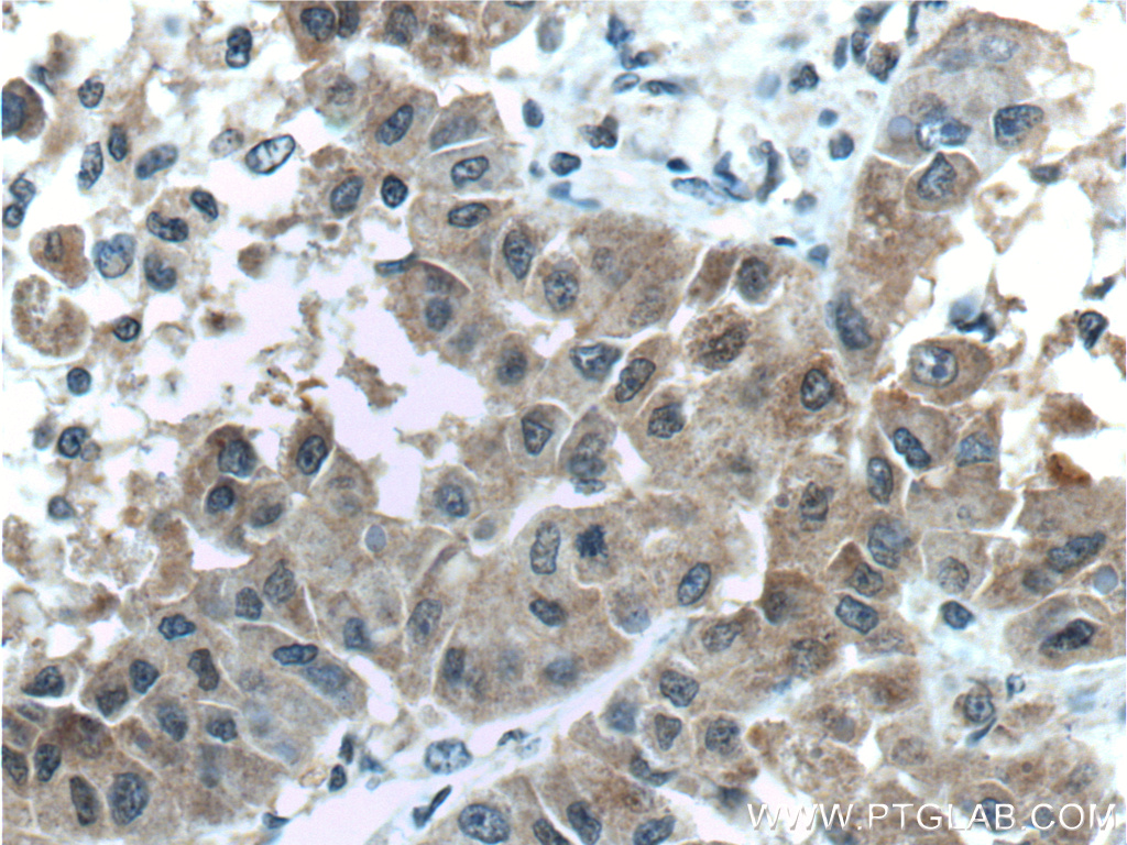 Arginase-1 Monoclonal antibody
