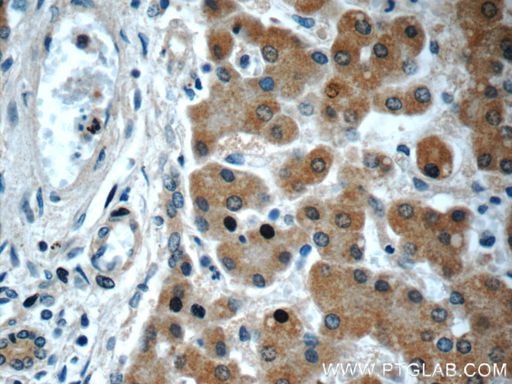 GOSR2/Membrin Monoclonal antibody
