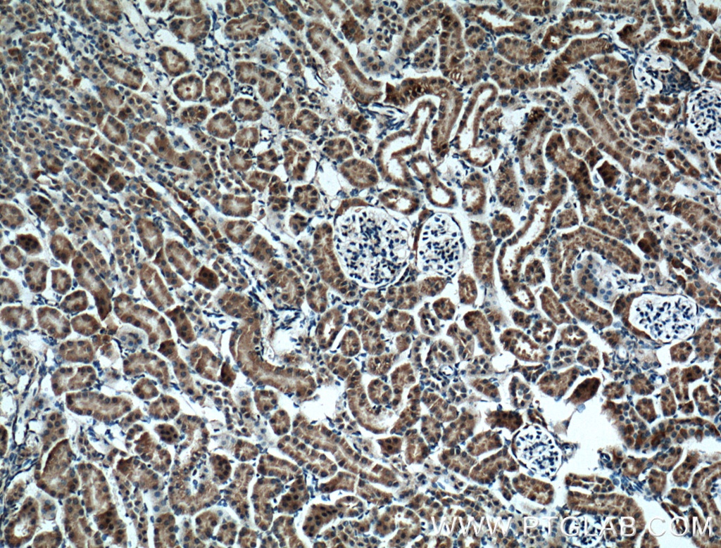 BBS5 Monoclonal antibody