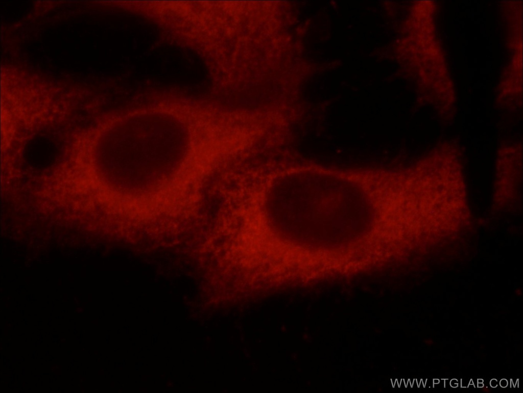 C9orf72 Monoclonal antibody