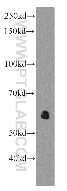 AEBP2 Monoclonal antibody