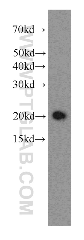 STMN3 Monoclonal antibody
