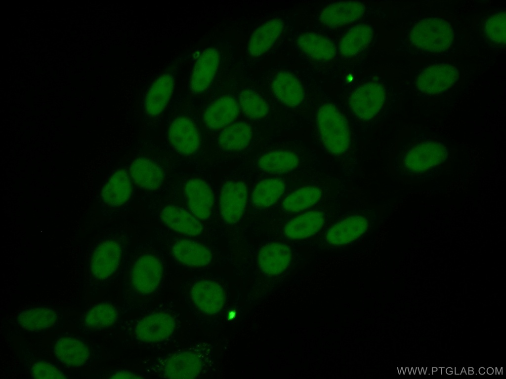 ANP32B Monoclonal antibody