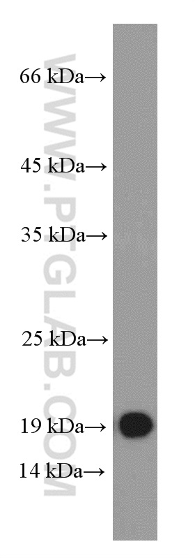 IFNA1 Monoclonal antibody
