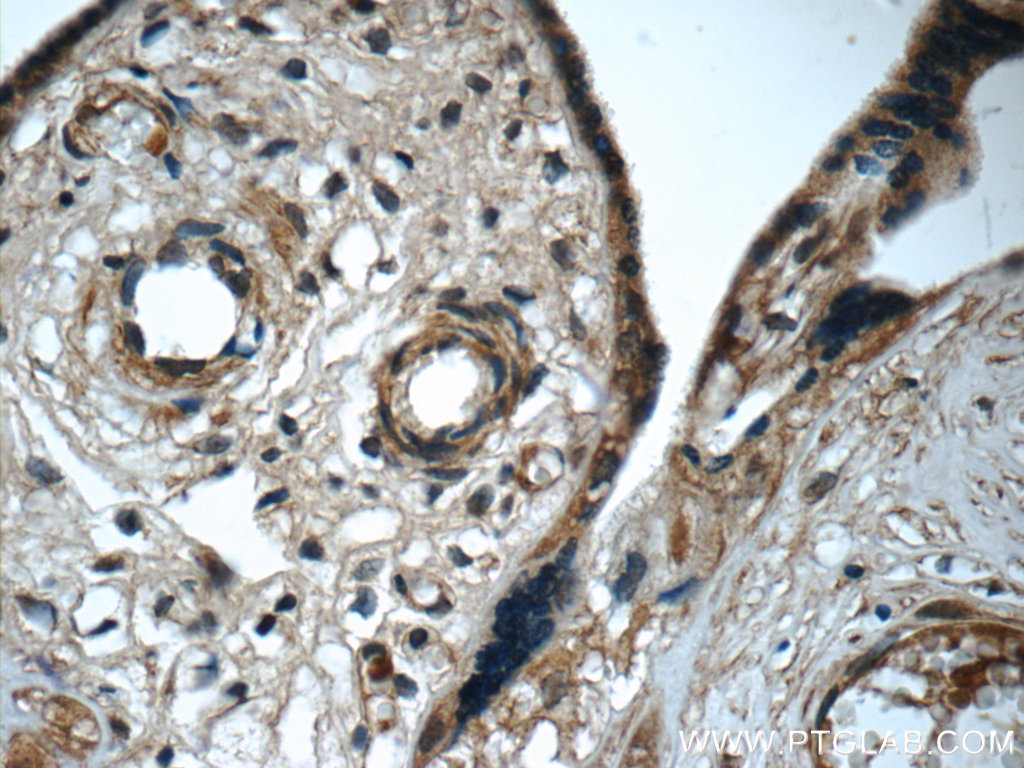 IL-27 Monoclonal antibody