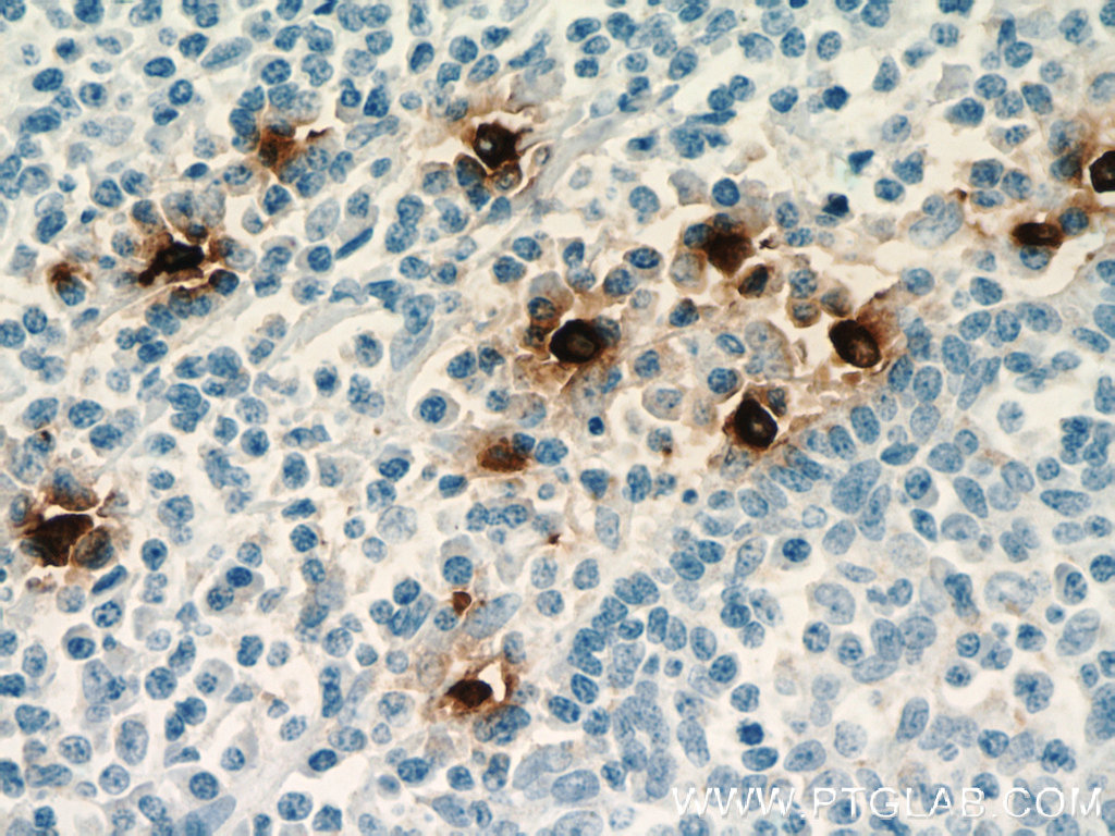 TPSAB1 Monoclonal antibody