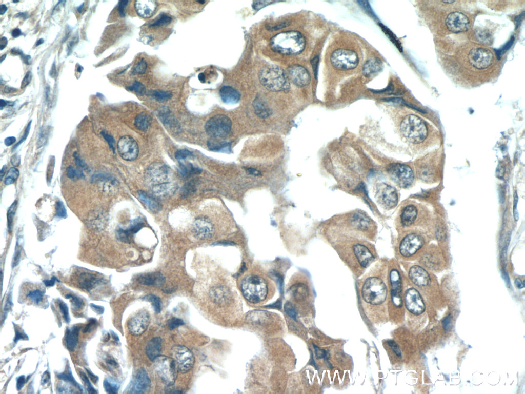 Zinc Alpha 2 Glycoprotein Monoclonal antibody
