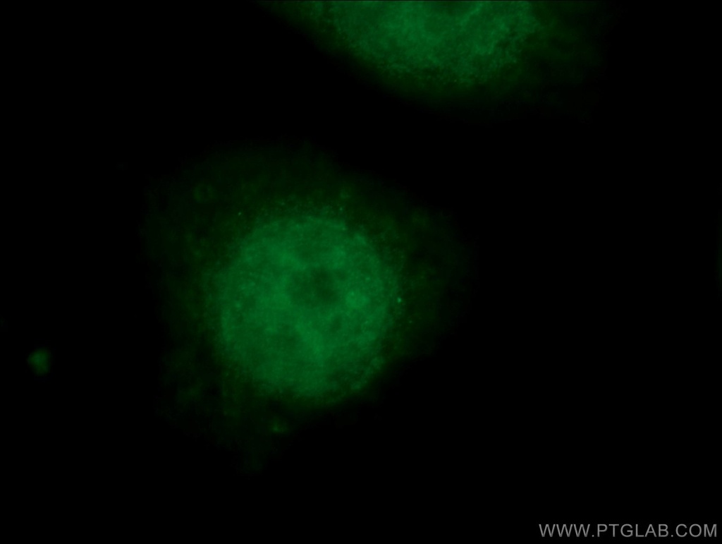 SMARCE1 Monoclonal antibody