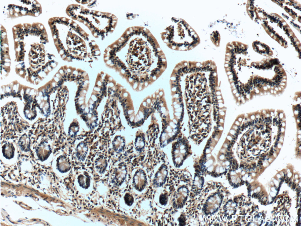 IL-22RA2 Monoclonal antibody