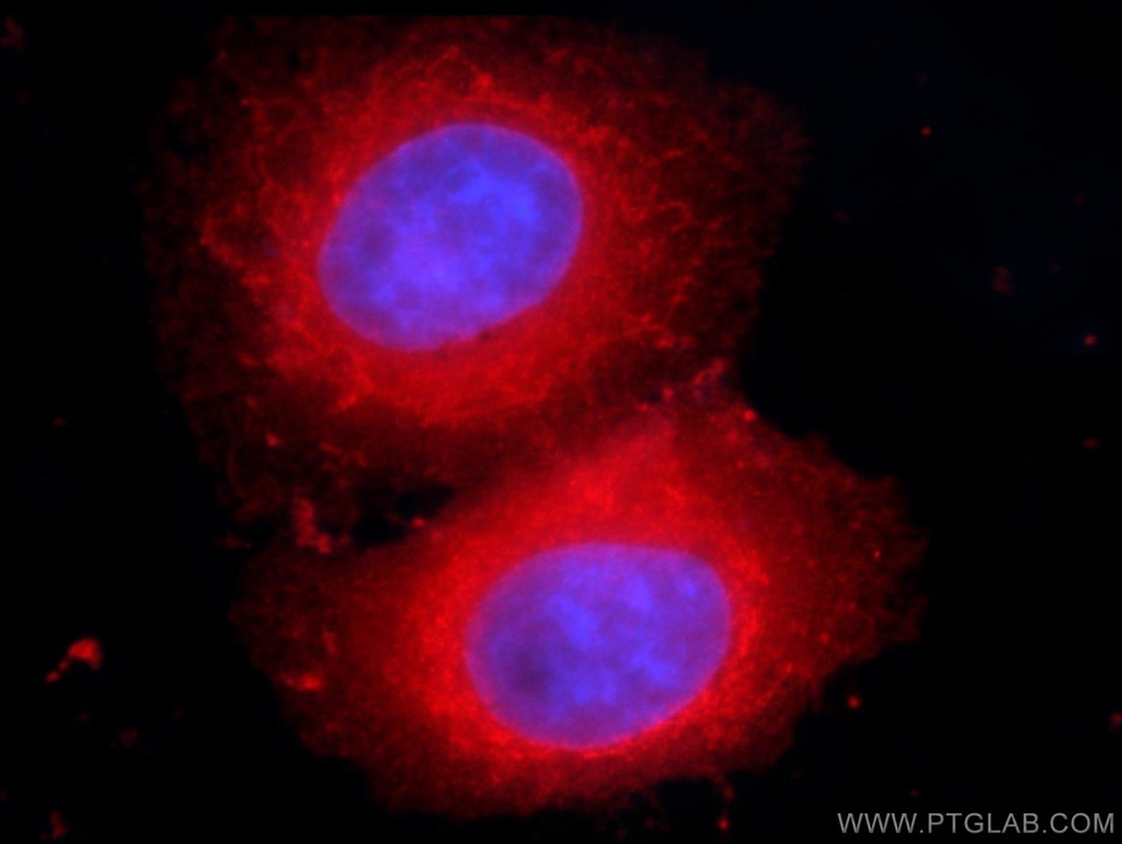 VAPB Monoclonal antibody