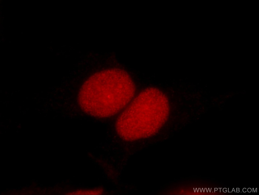 DEK Monoclonal antibody