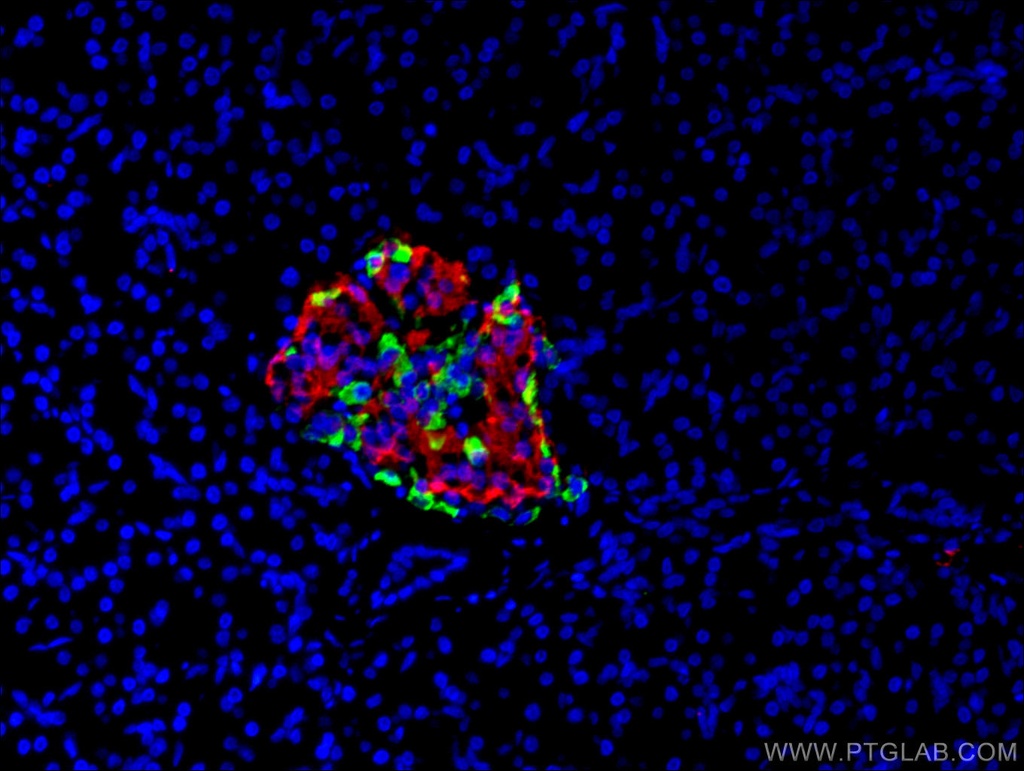 INS Monoclonal antibody