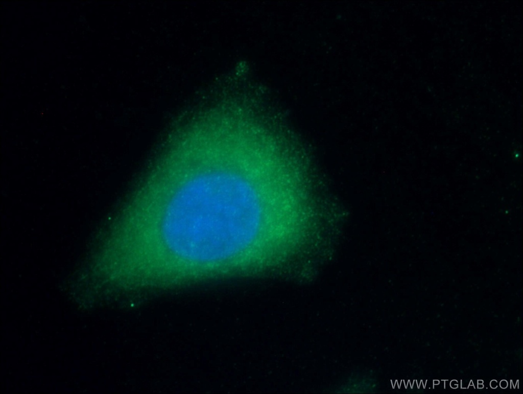 Apolipoprotein AI Monoclonal antibody