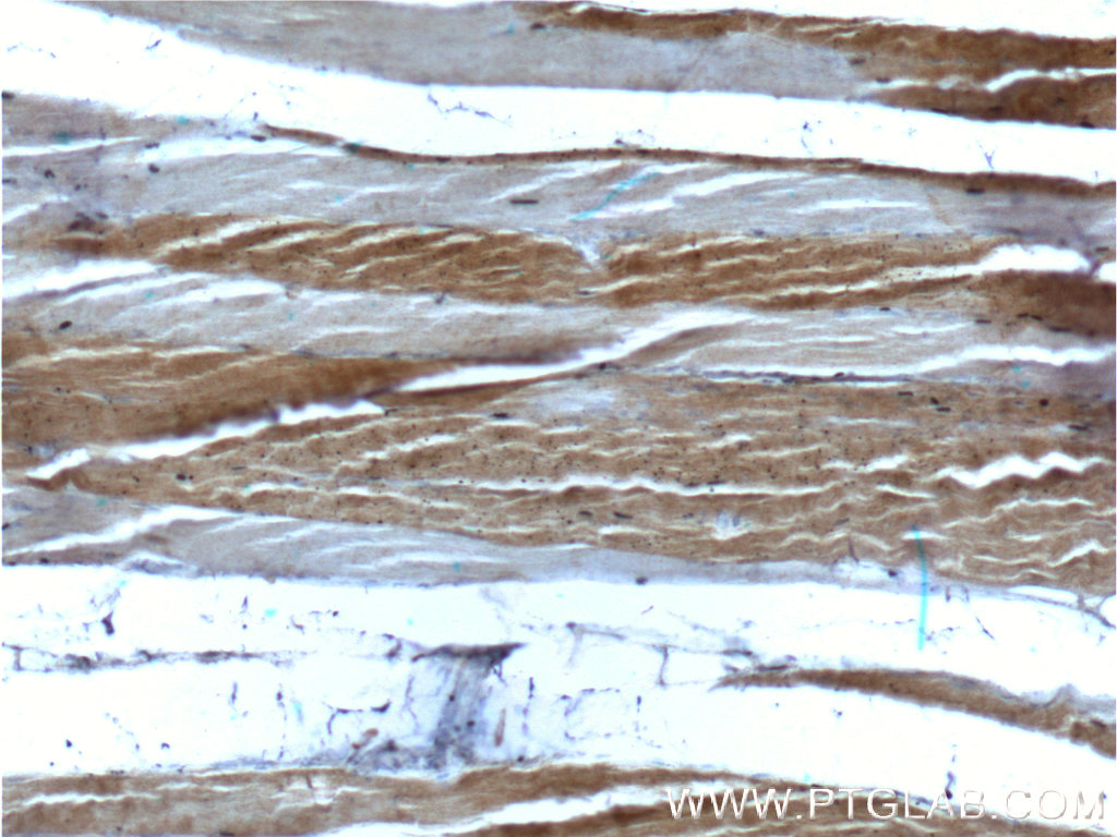 MYH2-specific Monoclonal antibody