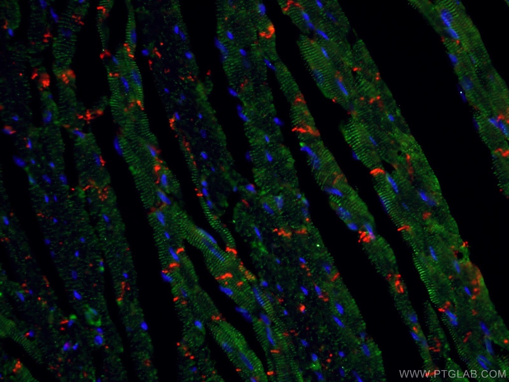 N-cadherin Monoclonal antibody