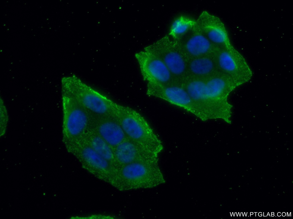 MALT1 Monoclonal antibody
