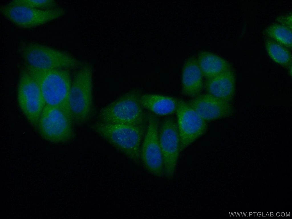 HPSE Monoclonal antibody