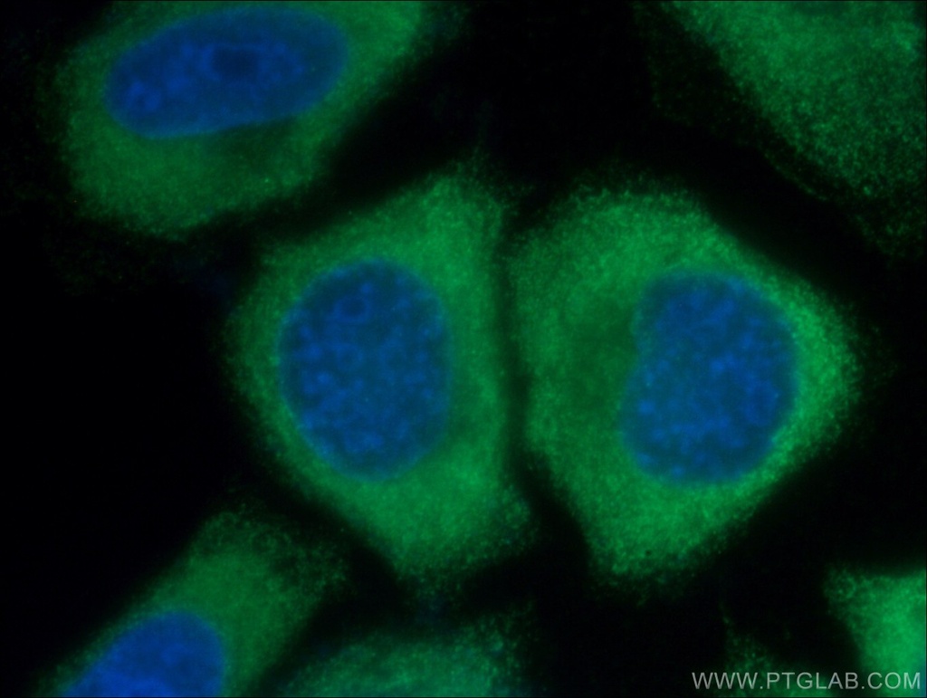 IL-33 Monoclonal antibody