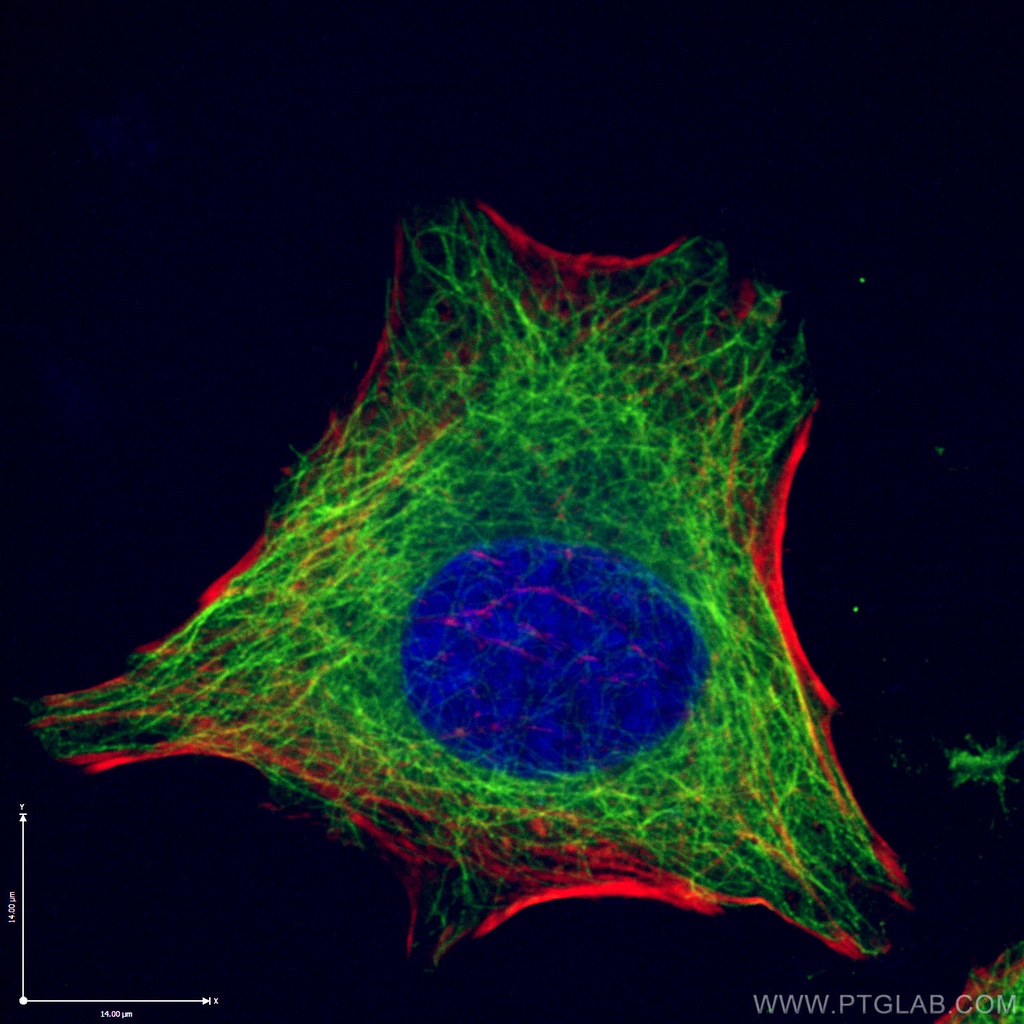 Beta Tubulin Monoclonal antibody