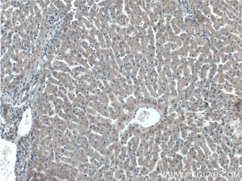 C4 Gamma Chain Monoclonal antibody