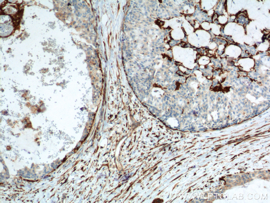 CNN2 Monoclonal antibody
