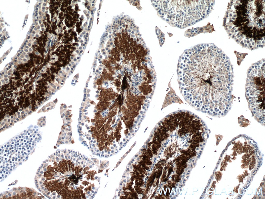 AKAP3 Monoclonal antibody