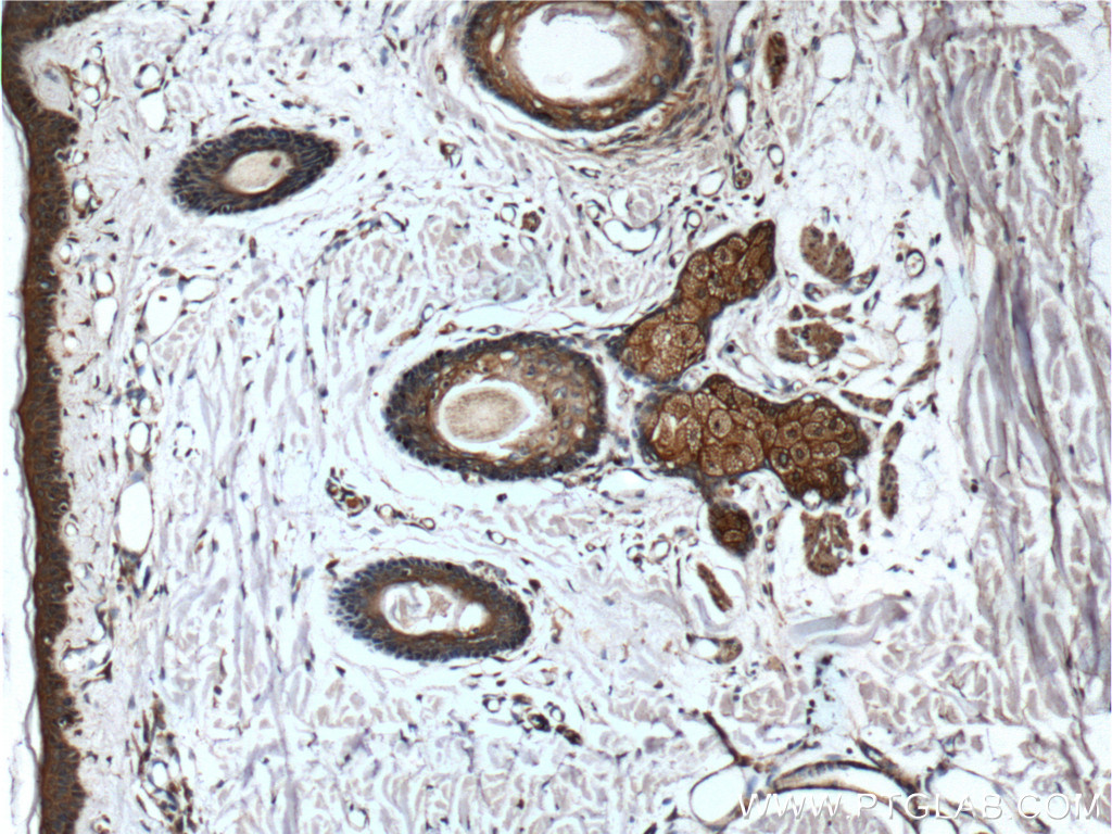 CD1d Monoclonal antibody