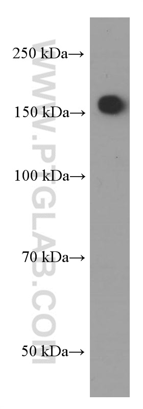 Nestin Monoclonal antibody