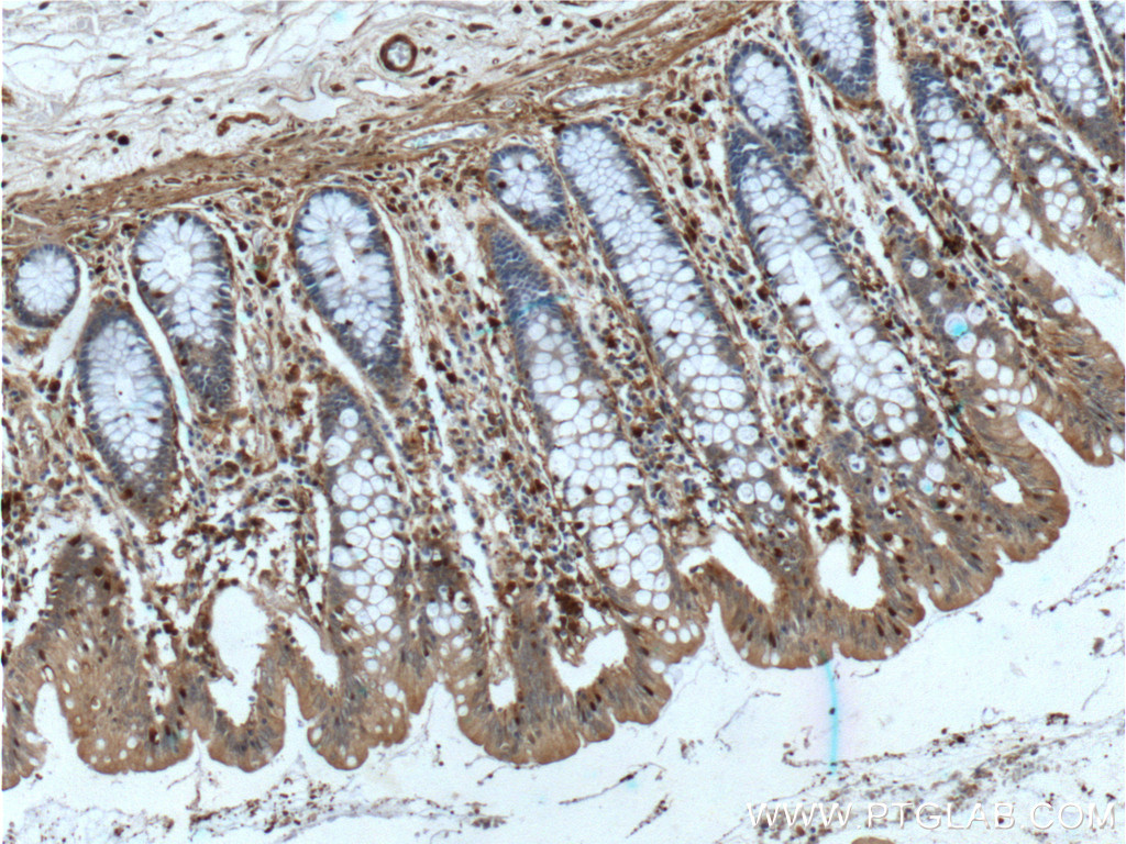 Gelsolin Monoclonal antibody
