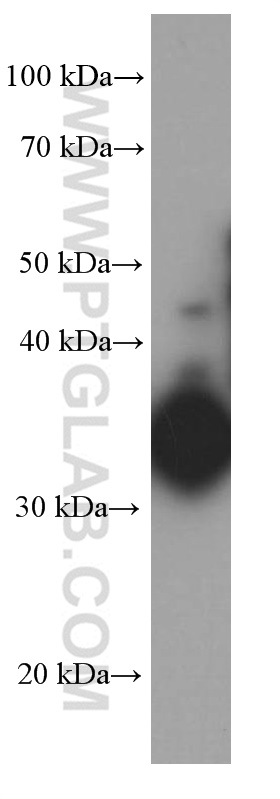 IL-12B Monoclonal antibody