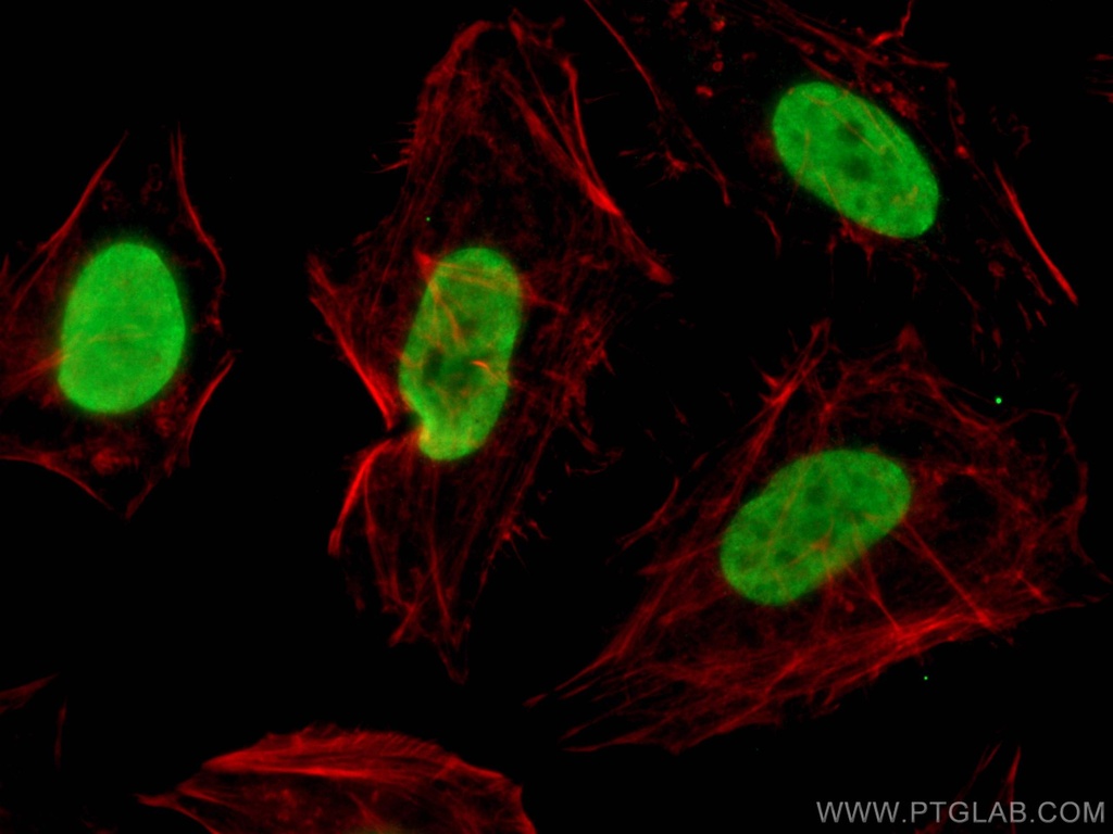 Pan Acetylation Monoclonal antibody