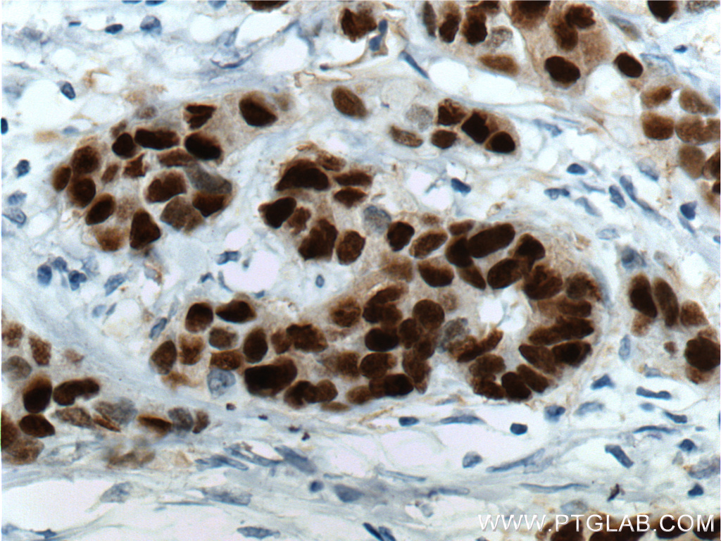 PR Monoclonal antibody