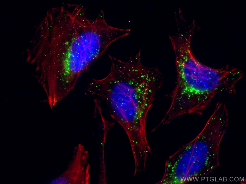LAMP2 Monoclonal antibody