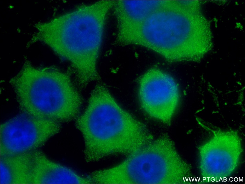 LIPH Monoclonal antibody