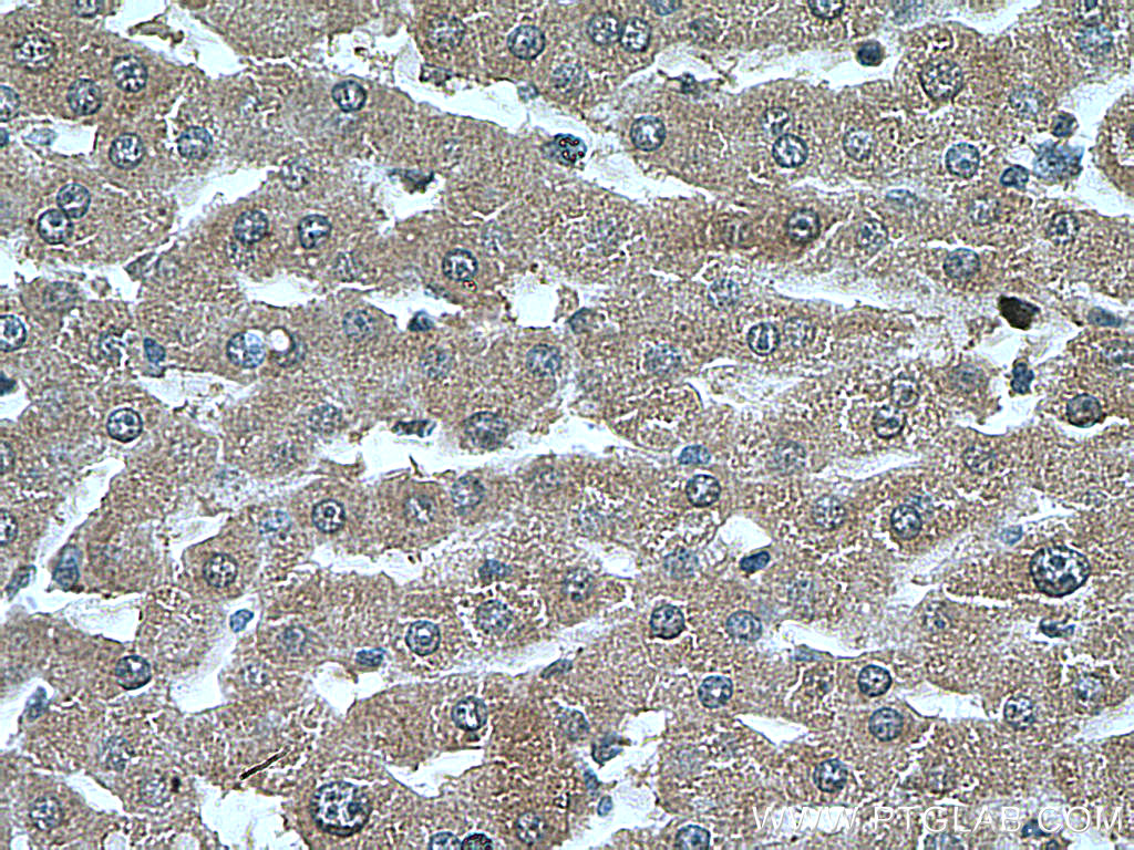 PEX5 Monoclonal antibody
