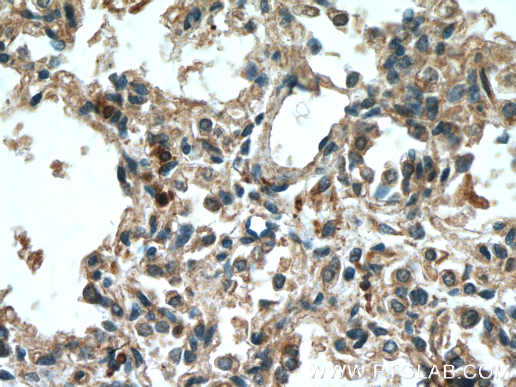 5 Lipoxygenase Monoclonal antibody