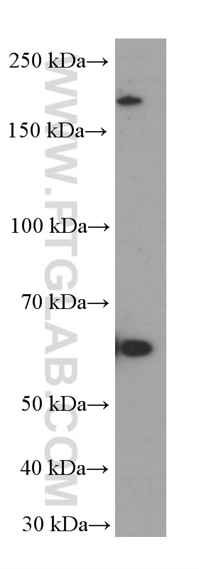 FOXN1 Monoclonal antibody
