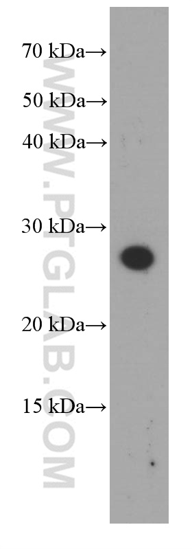 Dermatopontin Monoclonal antibody