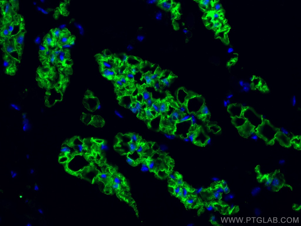 COX2/ Cyclooxygenase 2/ PTGS2 Monoclonal antibody