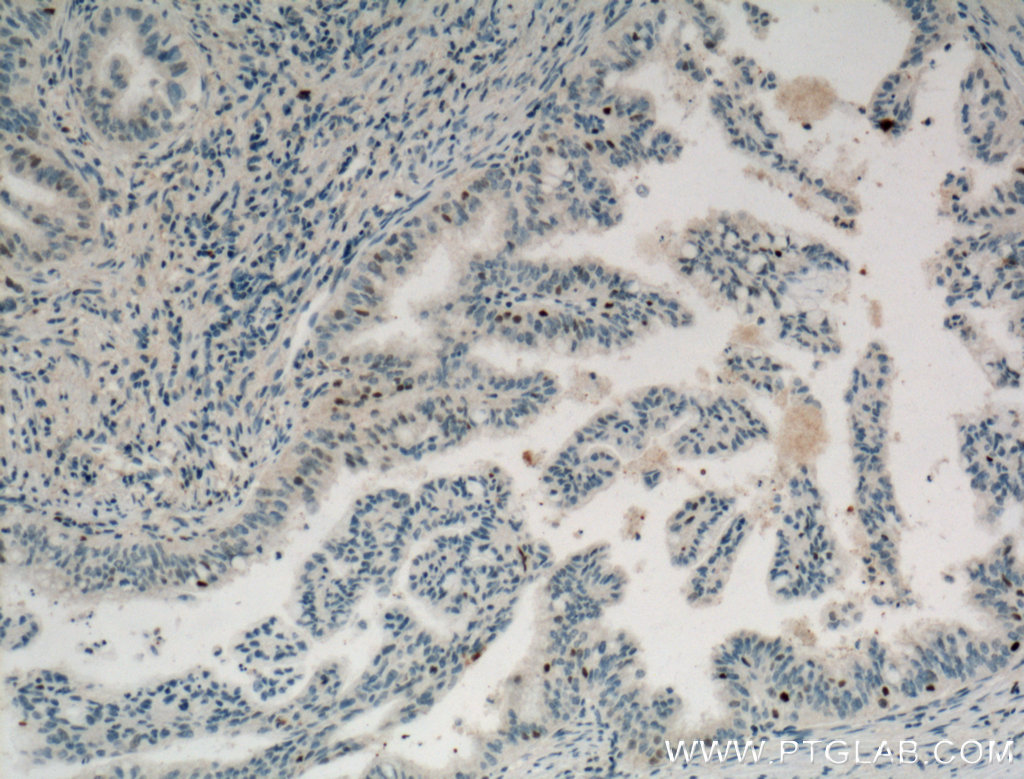 Cyclin D3 Monoclonal antibody