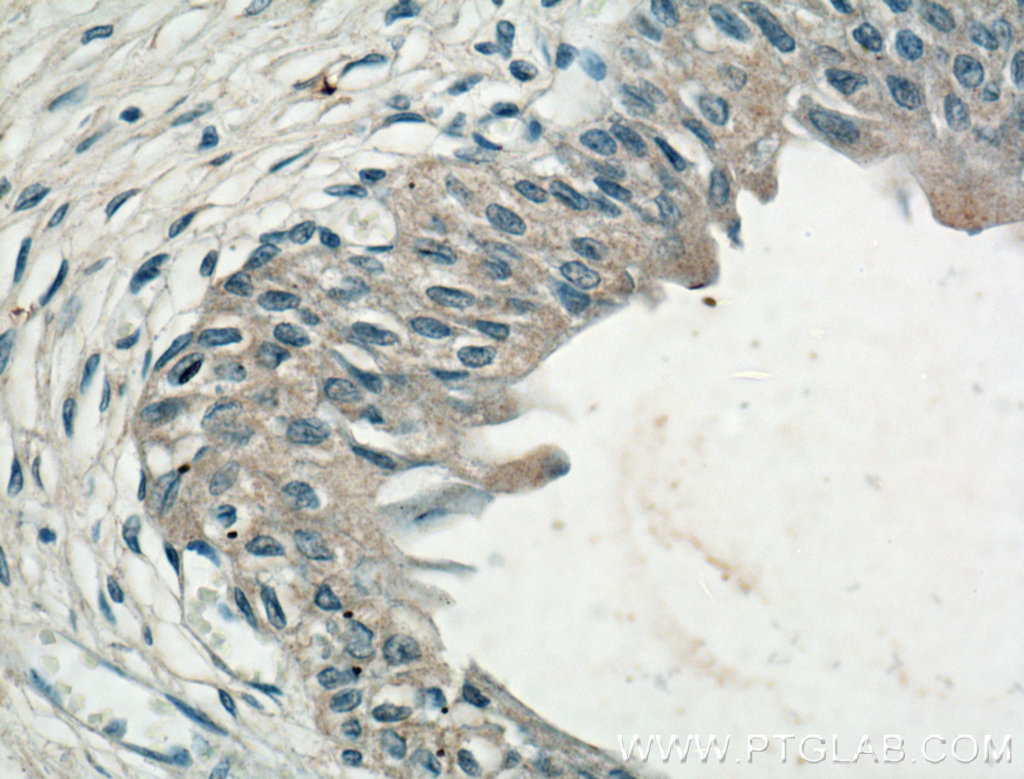 CHRNA5 Monoclonal antibody