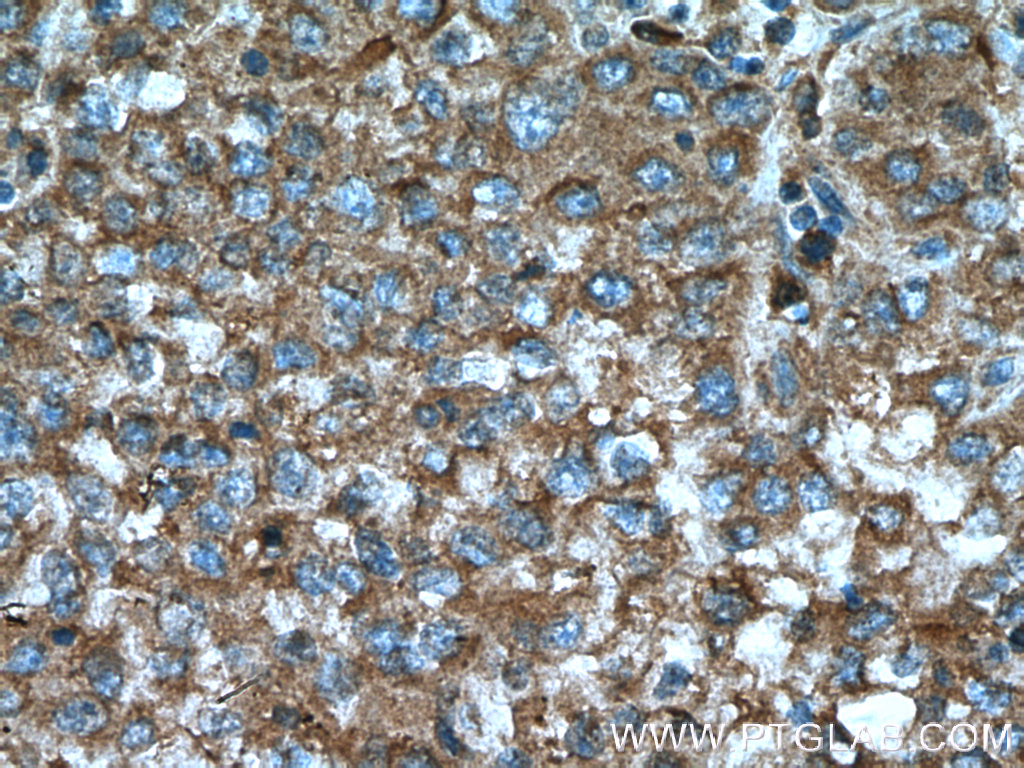 D2HGDH Monoclonal antibody